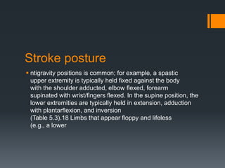Stroke posture
 ntigravity positions is common; for example, a spastic
upper extremity is typically held fixed against the body
with the shoulder adducted, elbow flexed, forearm
supinated with wrist/fingers flexed. In the supine position, the
lower extremities are typically held in extension, adduction
with plantarflexion, and inversion
(Table 5.3).18 Limbs that appear floppy and lifeless
(e.g., a lower
 