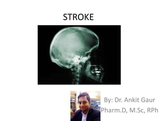 STROKE
By: Dr. Ankit Gaur
Pharm.D, M.Sc, RPh
 