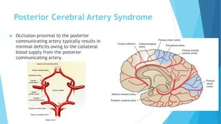 Posterior Cerebral Artery Syndrome
 Occlusion proximal to the posterior
communicating artery typically results in
minimal deficits owing to the collateral
blood supply from the posterior
communicating artery.
 