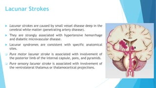 Lacunar Strokes
 Lacunar strokes are caused by small vessel disease deep in the
cerebral white matter (penetrating artery disease).
 They are strongly associated with hypertensive hemorrhage
and diabetic microvascular disease.
 Lacunar syndromes are consistent with specific anatomical
sites.
 Pure motor lacunar stroke is associated with involvement of
the posterior limb of the internal capsule, pons, and pyramids.
 Pure sensory lacunar stroke is associated with involvement of
the ventrolateral thalamus or thalamocortical projections.
 