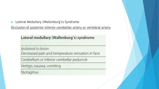  Lateral Medullary (Wallenburg’s) Syndrome
Occlusion of posterior inferior cerebellar artery or vertebral artery
 