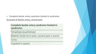  Complete basilar artery syndrome (locked-in syndrome)
Occlusion of Basilar artery, ventral pons
 