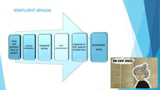 NONFLUENT APHASIA
 