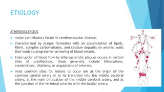 ETIOLOGY
ATHEROSCLEROSIS
 major contributory factor in cerebrovascular disease.
 characterized by plaque formation with an accumulation of lipids,
fibrin, complex carbohydrates, and calcium deposits on arterial walls
that leads to progressive narrowing of blood vessels.
 Interruption of blood flow by atherosclerotic plaques occurs at certain
sites of predilection, these generally include bifurcations,
constrictions, dilations, or angulations of arteries.
 most common sites for lesions to occur are at the origin of the
common carotid artery or at its transition into the middle cerebral
artery, at the main bifurcation of the middle cerebral artery, and at
the junction of the vertebral arteries with the basilar artery.
 