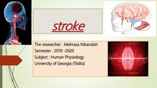 stroke
The researcher : Mehrasa Nikandish
Semester : 2019 -2020
Subject : Human Physiology
University of Georgia (Tbilisi)
 