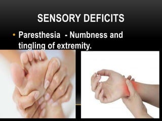 SENSORY DEFICITS
• Paresthesia - Numbness and
tingling of extremity.
 