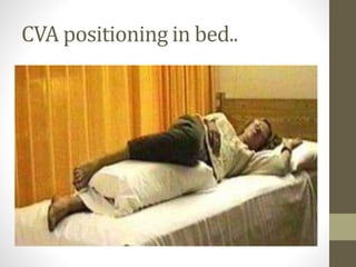 CVA positioning in bed..
 
