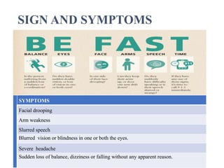 Stroke.ppt