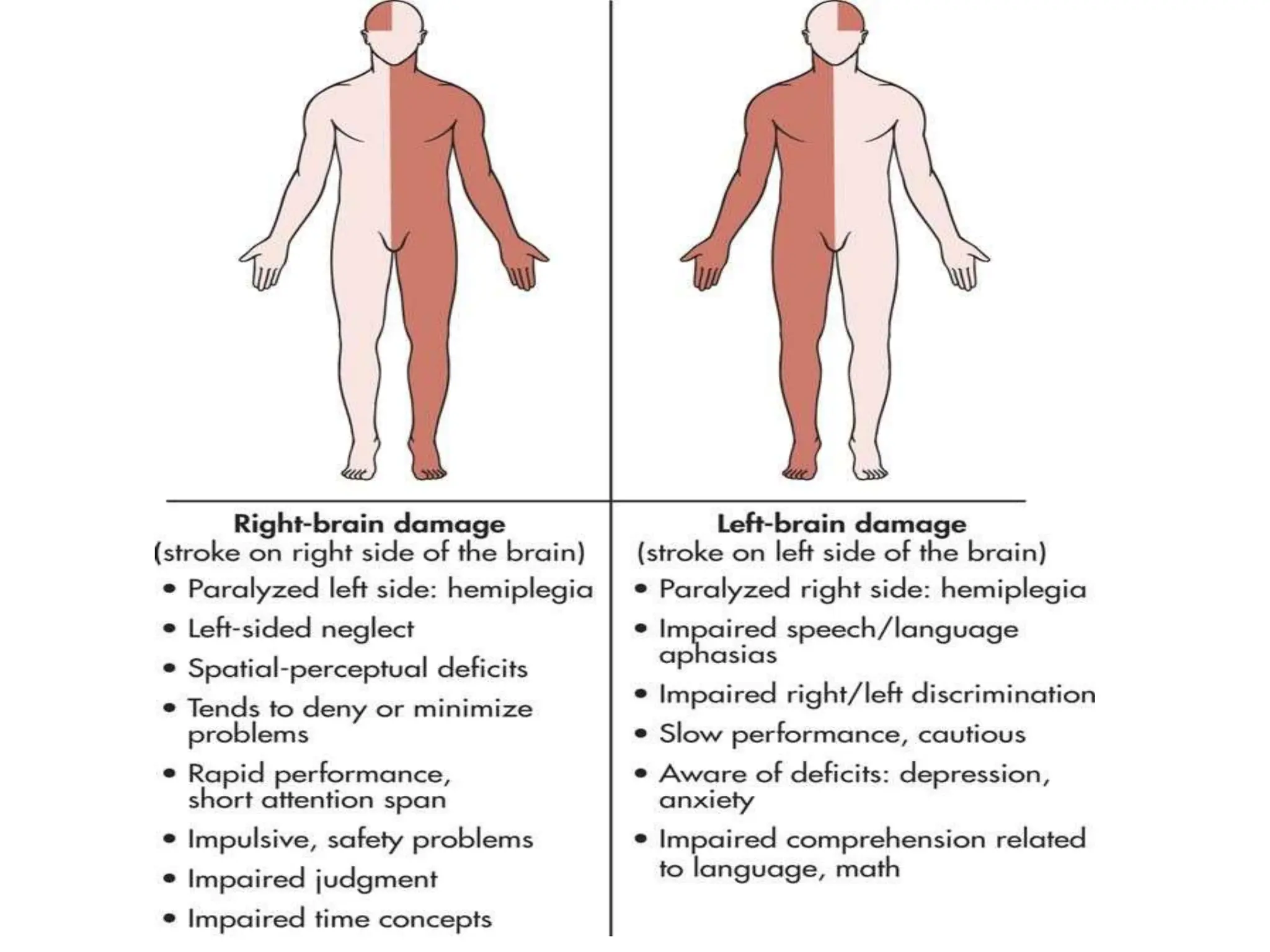Management of Cerebro vascular accident (CVA) | PPT