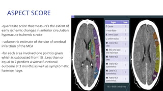 STROKE BY DR. NITHA THOMAS 2024 .pptx