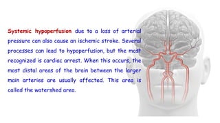 Systemic hypoperfusion due to a loss of arterial
pressure can also cause an ischemic stroke. Several
processes can lead to hypoperfusion, but the most
recognized is cardiac arrest. When this occurs, the
most distal areas of the brain between the larger
main arteries are usually affected. This area is
called the watershed area.
 