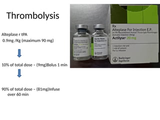Thrombolysis
Alteplase r tPA
0.9mg /Kg (maximum 90 mg)
10% of total dose – (9mg)Bolus 1 min
90% of total dose – (81mg)Infuse
over 60 min
 
