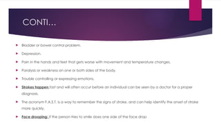 Stroke powerpoint presentation definition types | PPTX