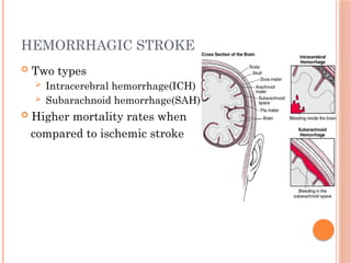HEMORRHAGIC STROKE
 Two types
 Intracerebral hemorrhage(ICH)
 Subarachnoid hemorrhage(SAH)
 Higher mortality rates when
compared to ischemic stroke
 