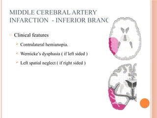 MIDDLE CEREBRAL ARTERY
INFARCTION - INFERIOR BRANCH
o Clinical features
 Contralateral hemianopia.
 Wernicke’s dysphasia ( if left sided )
 Left spatial neglect ( if right sided )
 