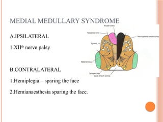 MEDIAL MEDULLARY SYNDROME
A.IPSILATERAL
1.XIIth
nerve palsy
B.CONTRALATERAL
1.Hemiplegia – sparing the face
2.Hemianaesthesia sparing the face.
 