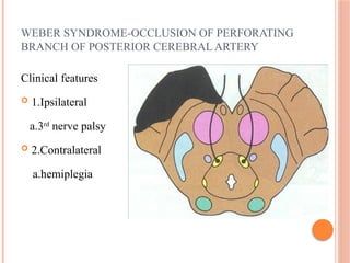 WEBER SYNDROME-OCCLUSION OF PERFORATING
BRANCH OF POSTERIOR CEREBRAL ARTERY
Clinical features
 1.Ipsilateral
a.3rd
nerve palsy
 2.Contralateral
a.hemiplegia
 