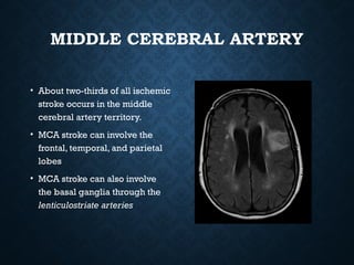 Stroke. .pptx