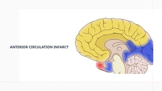 Stroke Classifications with CT/MRI Images | PPTX