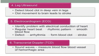 Comprehensive Overview and Management of Cerebrovascular Accident ...