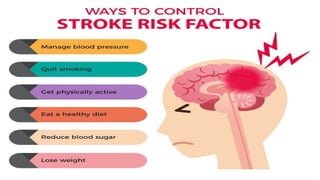 Comprehensive Overview and Management of Cerebrovascular Accident ...