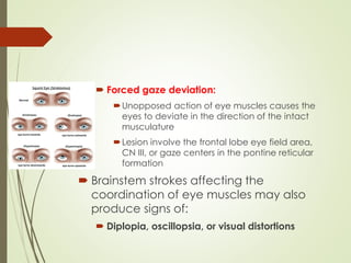 Stroke: Types, Symptoms, and Management.(NPT) Lecture 5 | PDF