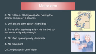 Motor arm
0. No drift (45 - 90 degrees) after holding the
arm for complete 10 seconds
1. Drift but the arrm doesn’t hit the bed
2. Some effort against gravity - hits the bed but
has some antigravity strength
3. No effort against gravity - limb falls
4. No movement
UN. Amputation or Joint fusion
 