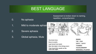 BEST LANGUAGE
0. No aphasia
1. Mild to moderate aphasia
2. Severe aphasia
3. Global aphasia, Mute
Assessment is broken down to naming,
repetition, comprehension
 