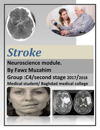 Stroke
Neuroscience module.
By Fawz Muzahim
Group :C4/second stage 2017/2018
Medical student/ Baghdad medical college
 