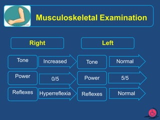 Stroke ppt by syeda nafeesa mumtaz | PPTX