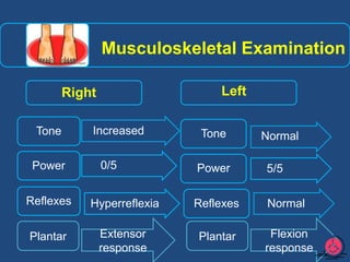 Stroke ppt by syeda nafeesa mumtaz | PPTX