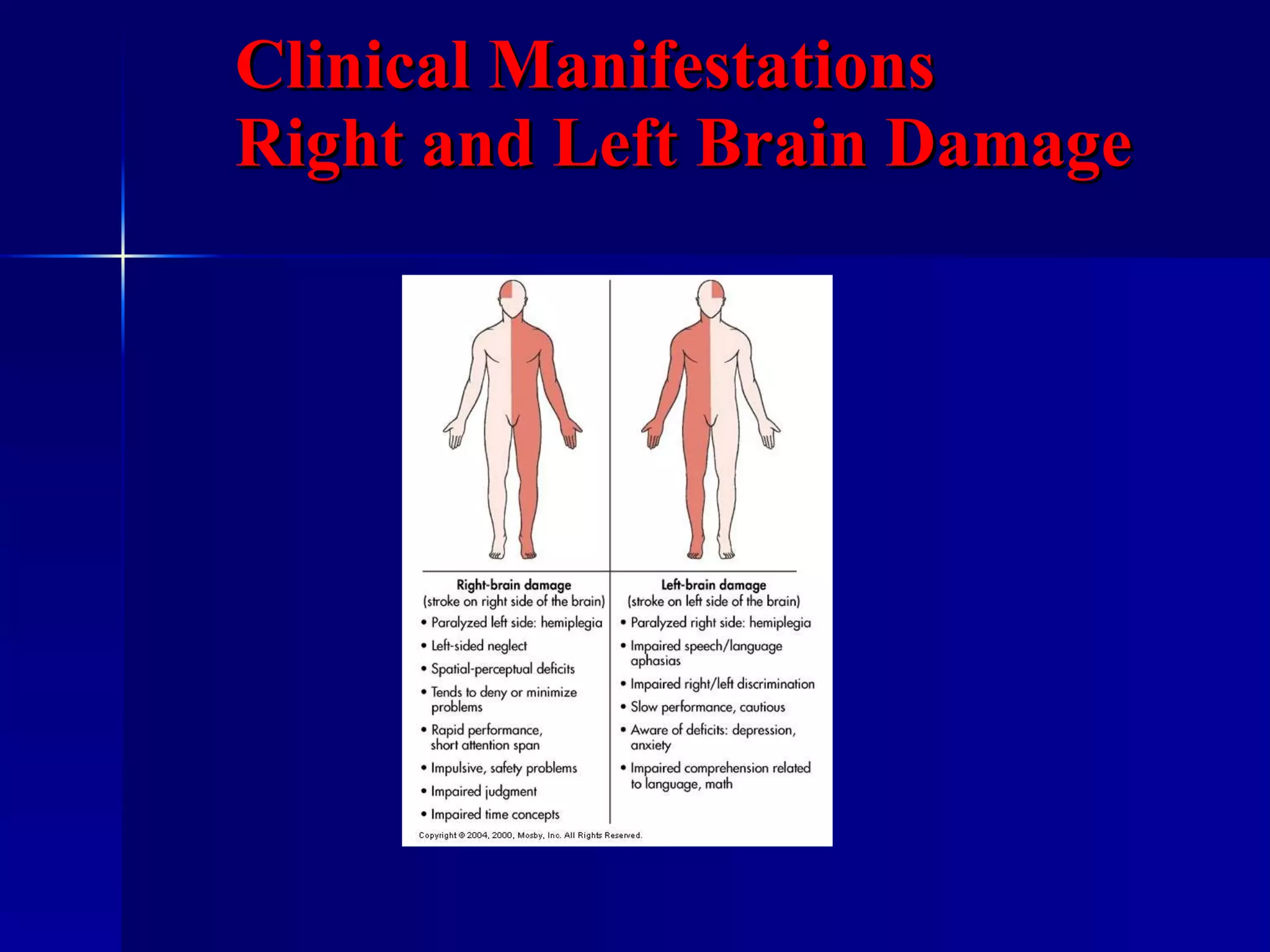 Clinical Manifestations Right and Left Brain Damage 