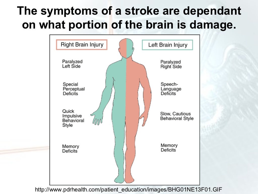 clinical presentations of stroke
