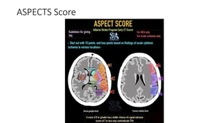 STROKE clinical and radiological findings.pptx