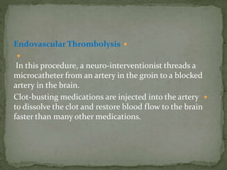 Endovascular Thrombolysis

In this procedure, a neuro-interventionist threads a
microcatheter from an artery in the groin to a blocked
artery in the brain.
Clot-busting medications are injected into the artery
to dissolve the clot and restore blood flow to the brain
faster than many other medications.
 