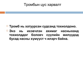 Тромбын цус харвалт




Тромб нь хатуурсан судсанд тохиолдоно.
Энэ нь ихэвчлэн ахимаг насныханд
тохиолддог боловч сүүлийн жилүүдэд
бусад насны хүмүүст ч илэрч байна.

 