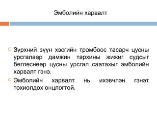 Эмболийн харвалт





Зүрхний зүүн хэсгийн тромбоос тасарч цусны
урсгалаар дамжин тархины жижиг судсыг
бөглөснөөр цусны урсгал саатахыг эмболийн
харвалт гэнэ.
Эмболийн харвалт нь ихэвчлэн гэнэт
тохиолдох онцлогтой.

 