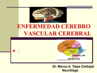 ENFERMEDAD CEREBRO
VASCULAR CEREBRAL
◼ :
Dr. Marco A. Taipe Carbajal
Neurólogo
 