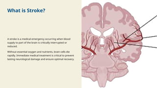 What is Stroke?
A stroke is a medical emergency occurring when blood
supply to part of the brain is critically interrupted or
reduced.
Without essential oxygen and nutrients, brain cells die
rapidly. Immediate medical treatment is critical to prevent
lasting neurological damage and ensure optimal recovery.
 