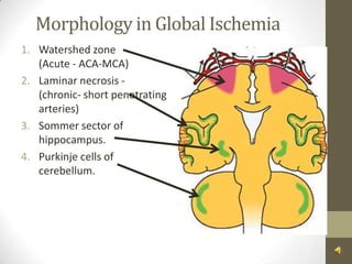 Morphology in Global IschemiaWatershed zone (Acute - ACA-MCA)Laminar necrosis - (chronic- short penetrating arteries)Sommer sector of hippocampus.Purkinje cells of cerebellum.