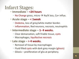 Infarct Stages:Immediate – <24 hoursNo Change gross, micro  Na/K loss, Ca+ influx.Acute stage – < 1week Oedema, loss of grey/white matter border.Inflammation, Red neurons, necrosis, neutrophilsIntermediate stage – 1- 4 weeks.Clear demarcation, soft friable tissue, cystsMacrophages, liquifactive necrosisLate stage – > 4 weeks.Removal of tissue by macrophagesFluid filled cysts with dark grey margin (gliosis)Gliosis – proliferation of glia at periphery. 