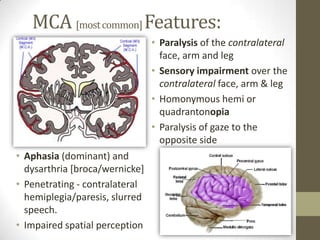 MCA [most common] Features:Paralysis of the contralateral face, arm and legSensory impairment over the contralateral face, arm & legHomonymous hemi or quadrantonopiaParalysis of gaze to the opposite sideAphasia (dominant) and dysarthria [broca/wernicke]Penetrating - contralateral hemiplegia/paresis, slurred speech.Impaired spatial perception