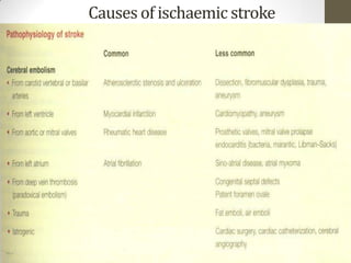 Causes of ischaemic stroke