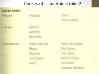 Causes of ischaemic stroke 2