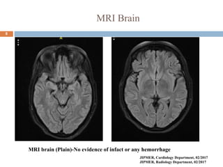 MRI Brain
8
MRI brain (Plain)-No evidence of infact or any hemorrhage
JIPMER, Cardiology Department, 02/2017
JIPMER, Radiology Department, 02/2017
 