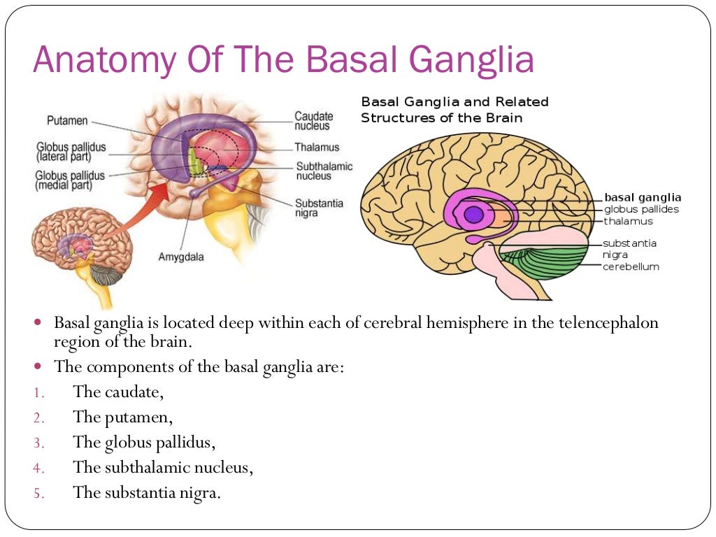 Stroke basal ganglia bleed