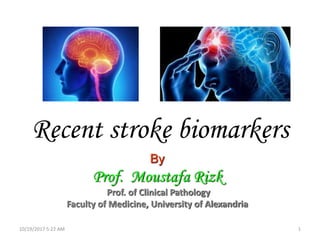 Recent stroke biomarkers
By
Prof. Moustafa Rizk
Prof. of Clinical Pathology
Faculty of Medicine, University of Alexandria
10/19/2017 5:22 AM 1
 