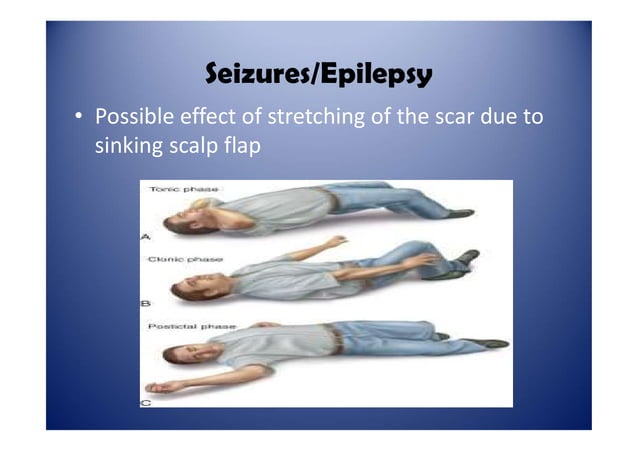 Stroke Care of Patient With Post Decompressive Craniectomy | PPT