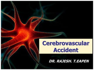 Cerebrovascular
Accident
DR. RAJESH. T.EAPEN
 