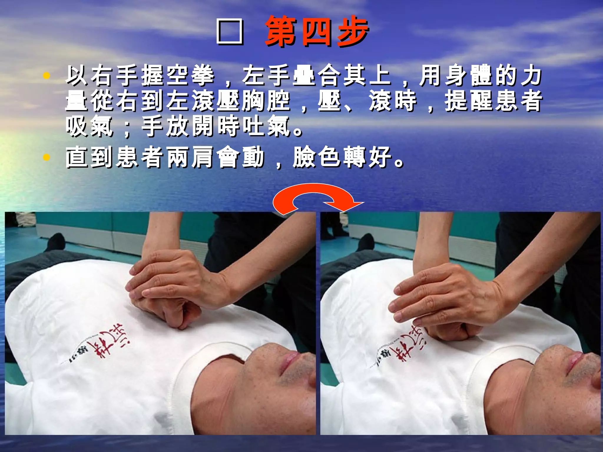 第四步
• 以右手握空拳，左手疊合其上，用身體的力
    量從右到左滾壓胸腔，壓、滾時，提醒患者
    吸氣；手放開時吐氣。
•   直到患者兩肩會動，臉色轉好。
 